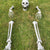 5pc Halloween Skeleton Head, Arms and Legs